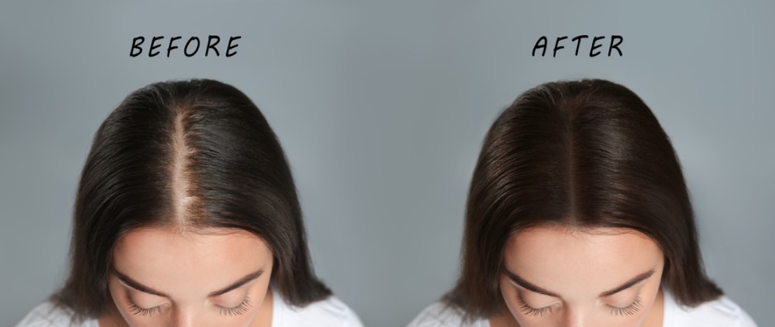 tips to get thicker hairs
