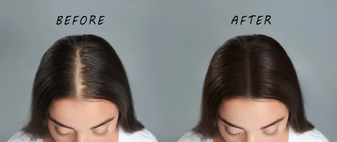 tips to get thicker hairs
