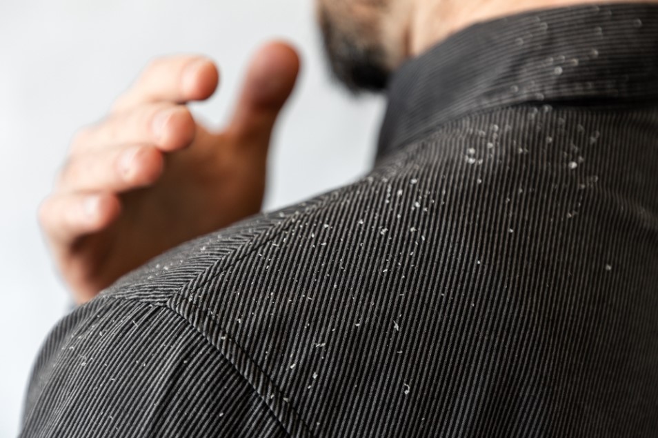 dandruff collected on a shirt