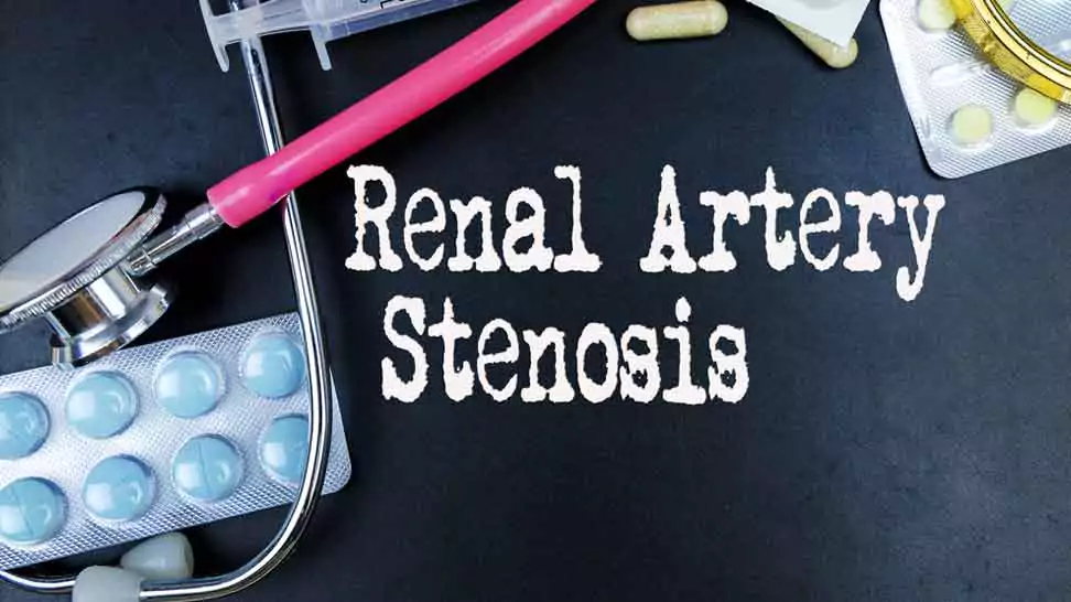 assessing for arterial stenosis
