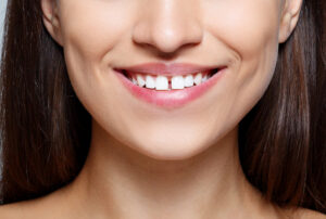 a woman having gap between teeth
