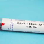 esr blood test