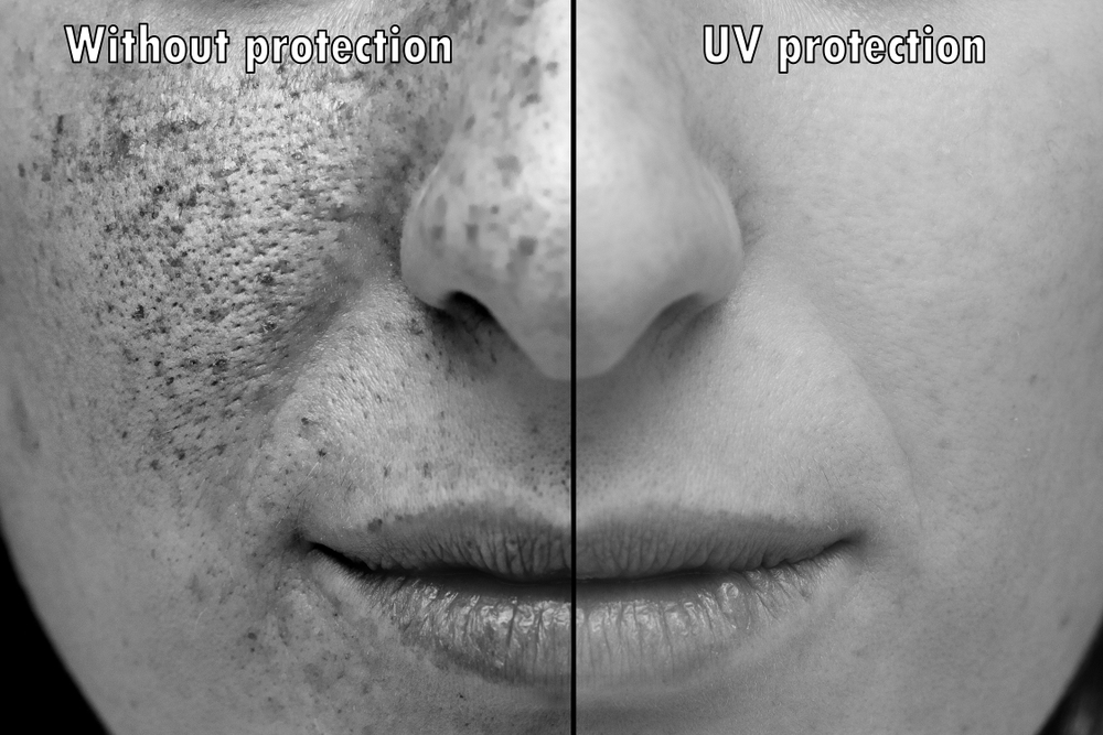 effect of uv rays on skin