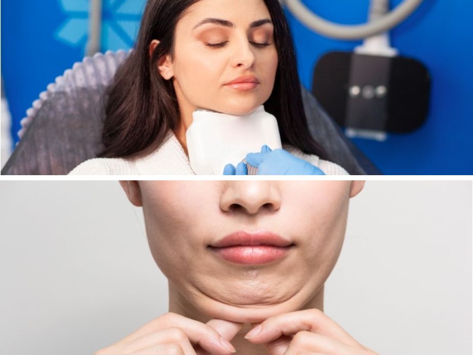 medical treatments to reduce double chin fat