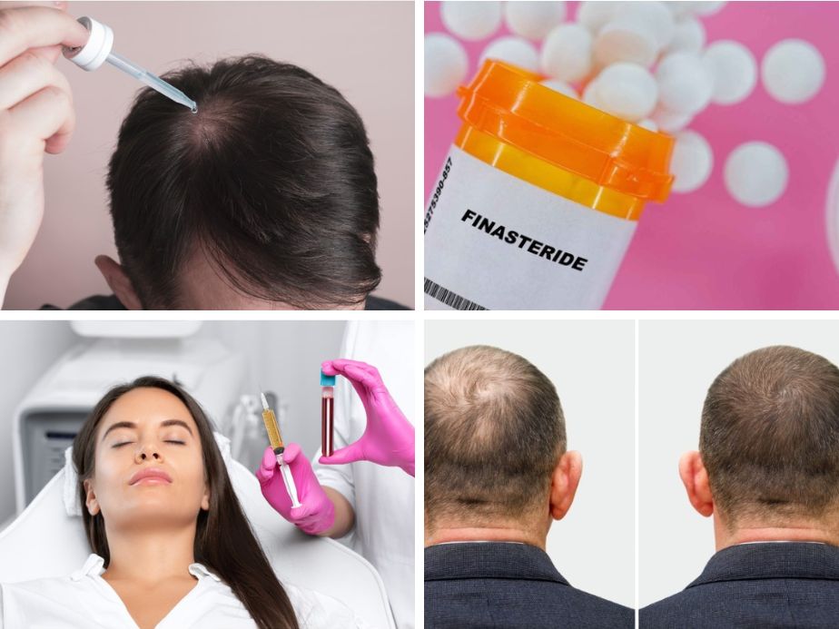 medical treatments for increased hair density