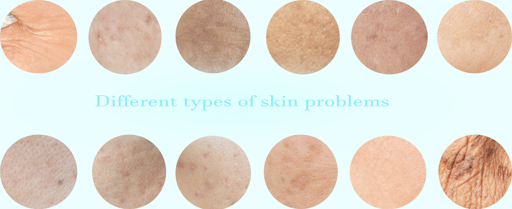 different types of skin