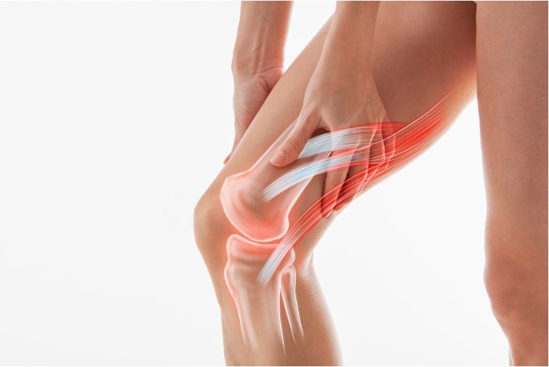 knee pain meniscus inflamed human leg medically accurate representation of sciatica