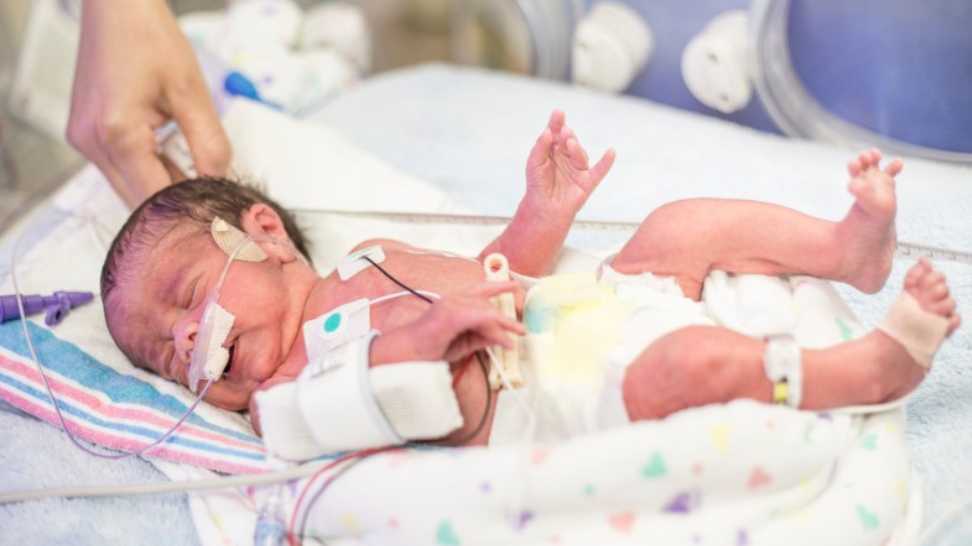 newborn premature baby in the nicu intensive care